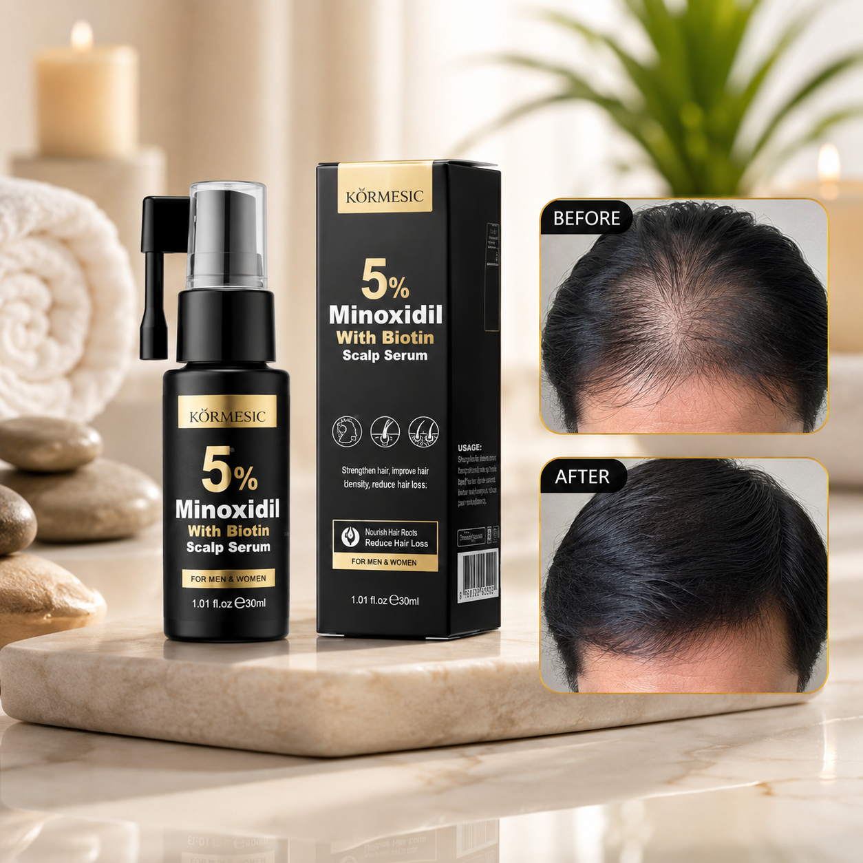 Kormesic Minoxidil Serum